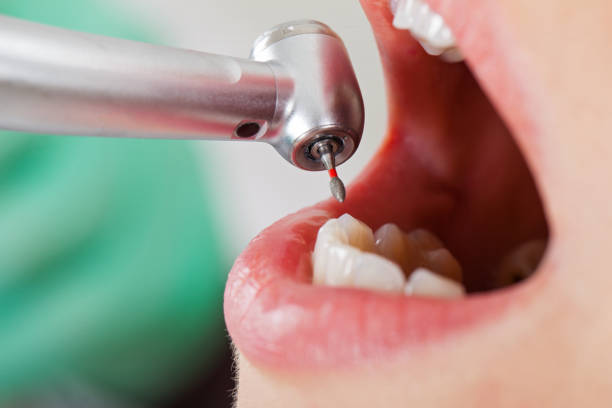 Best Pediatric Emergency Dentist in Lake Hiawatha, NJ